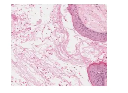 Gorlin-Goltz Syndrome - Case Report and Literature Review Emphasizing on Diagnostic Methods - Issue cover